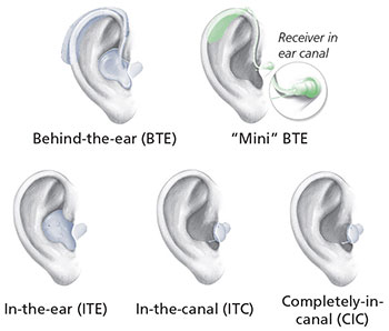 A picture with 5 different hearing aids: Behind-the-Ear, “Mini” BTE, In-the-ear (ITE), In-the-canal (ITC), and Completely-in-canal (CIC).